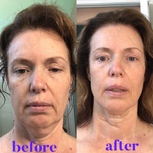 Lifting & Firming Neck Cream